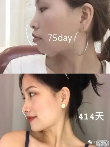 纯侧面照是侧脸杀(当然下面那张是我化妆的嘿嘿)还有下巴之前又短又圆