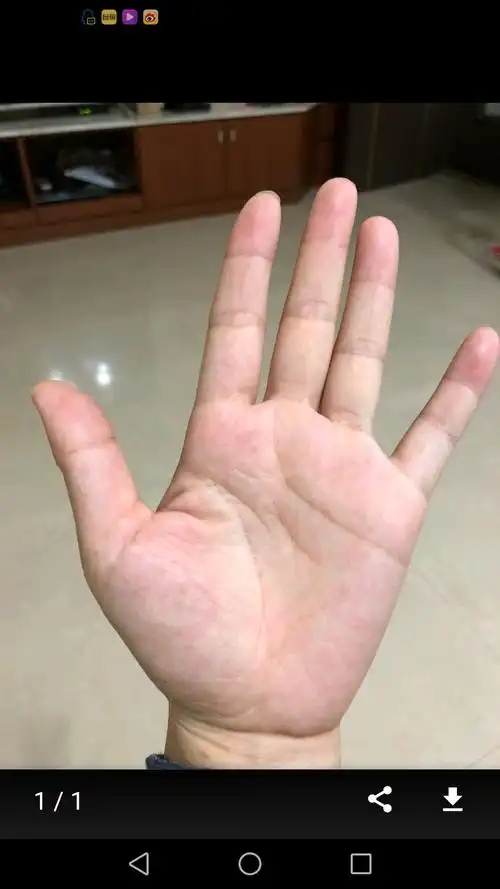 1,肝癌,我国原发性肝癌90%以上都是乙肝表面抗原阳性患者,乙肝病毒的