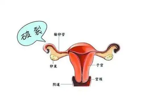 输卵管堵塞有什么样症状_输卵管切除对女人身体有什么影响- 求医网