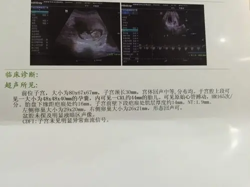 孕10周 3天 去做了彩超 结果在下面的照片上 麻烦各位教授看下 是否