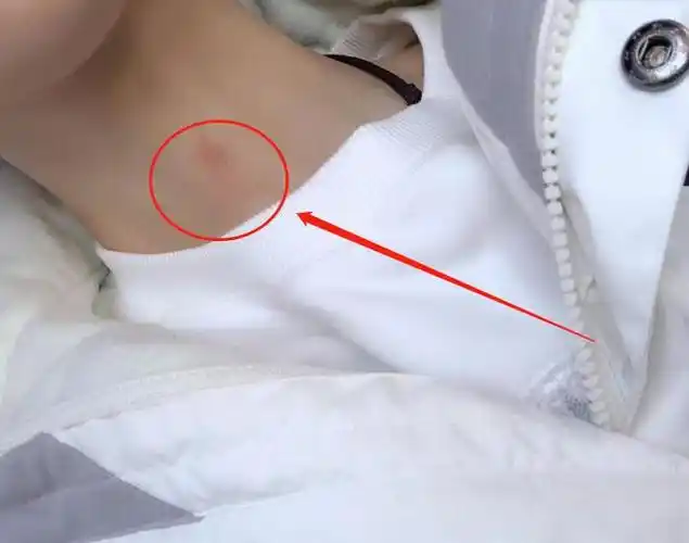 熊祁晒"草莓印"是要曝光恋情吗?熊仔知道真相后:老攻心疼你_网易订阅