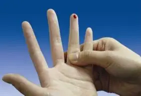 询问,国外对感冒的孩子是从鼻腔里采样,而国内医院大多还是采指尖血