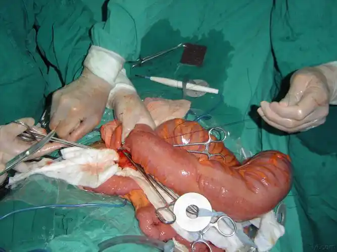 精彩的手术照片