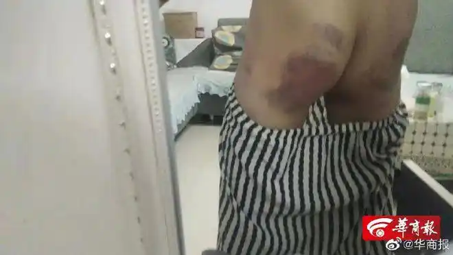 西安11岁男孩被辅导班老师殴打 家长能要求哪些赔偿