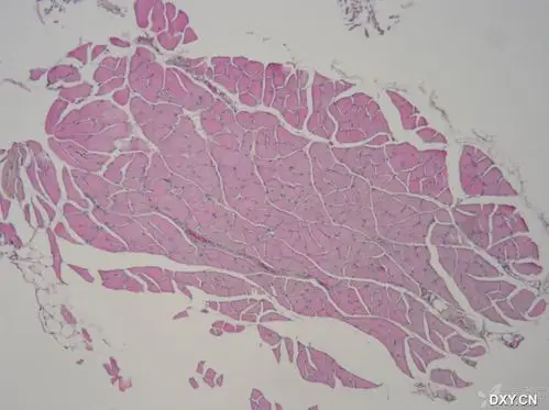 小鼠骨骼肌he染色出现问题,求助