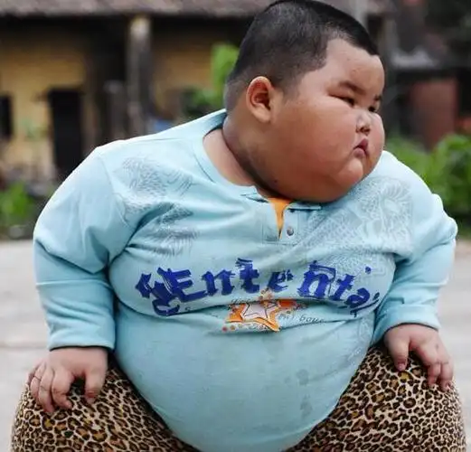 孩子,肥胖,家长,医生,过度肥胖,逗笑