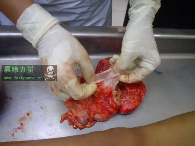 女孩被强奸后的刨俯