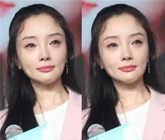 原创看到整容失败的明星你还会去整容吗