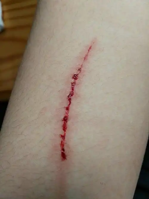手臂被金属划破.