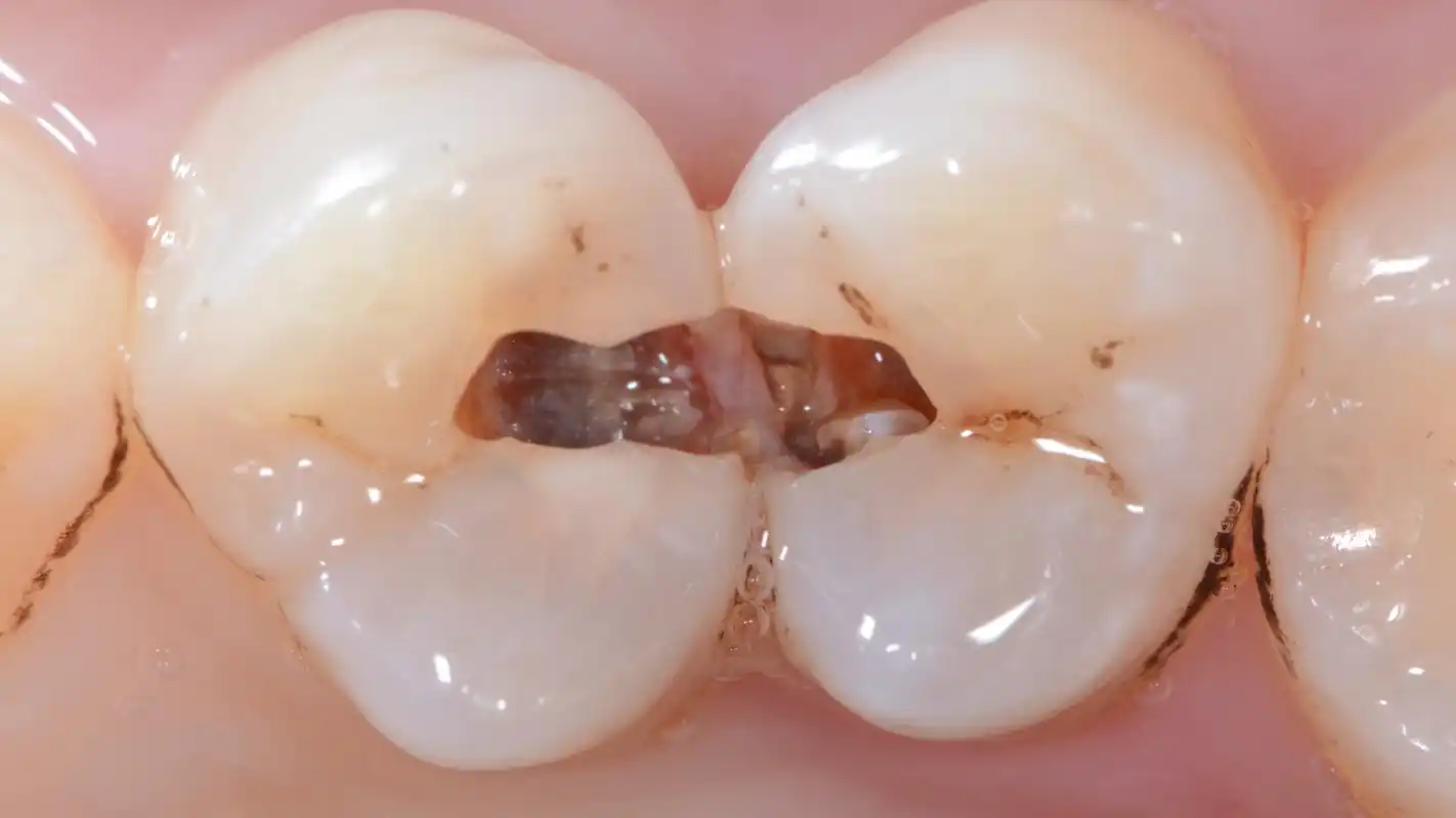 刘政文主治医师