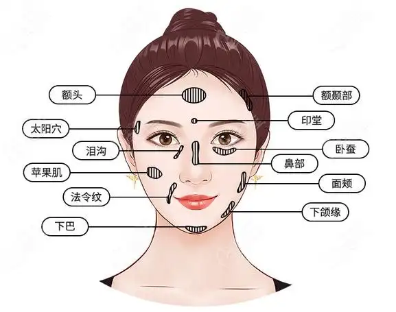 太原华美脂肪填充口碑好的医生是谁打算做全脸填充让面部更饱满些