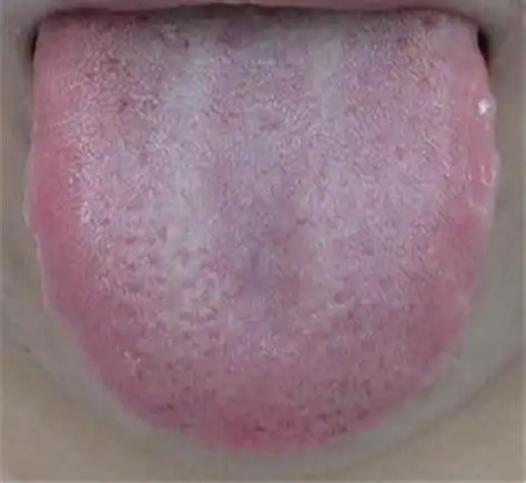 女性舌苔厚白吃什么药调理
