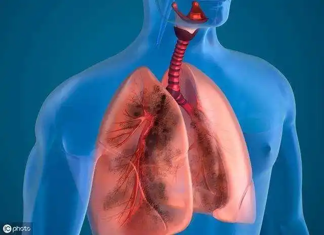 关于戒烟一年了肺部变化图片的信息