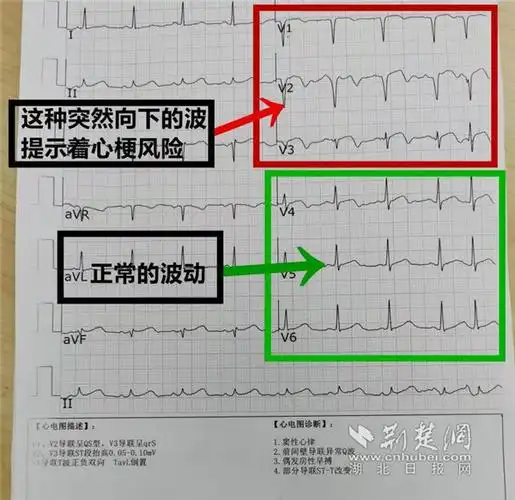 三次心梗预警被当耳旁风男子驱车一百多公里返汉保命