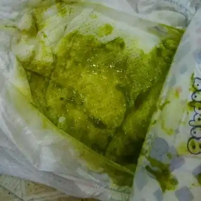 宝宝五个月,平时一天一次大便.这几天一天四次,拉的都是绿色便便.