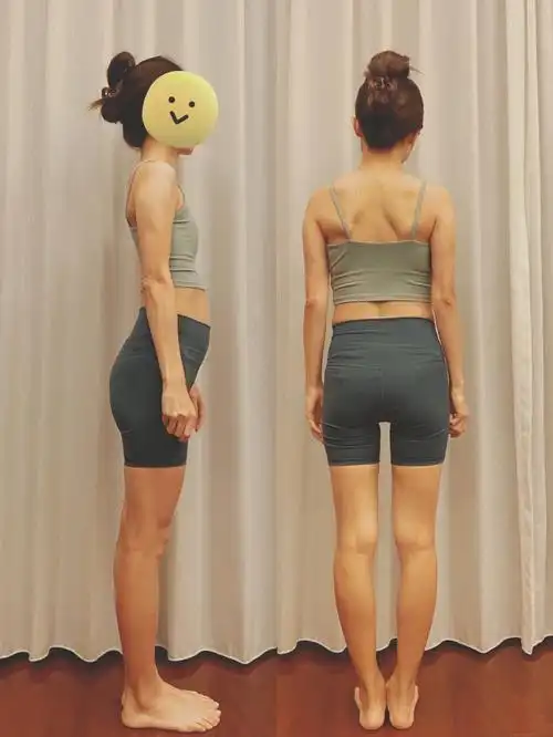 如何矫正体态我是个难看的瘦子