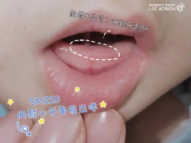 去他娘娘家玩,逗他笑看到小白点问是不是长牙了°粗心妈妈才发现宝宝