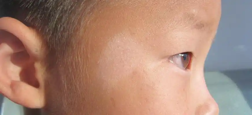 北京小儿寄生虫病专家_北京治疗小儿寄生虫病哪个专家好_北京治疗小儿