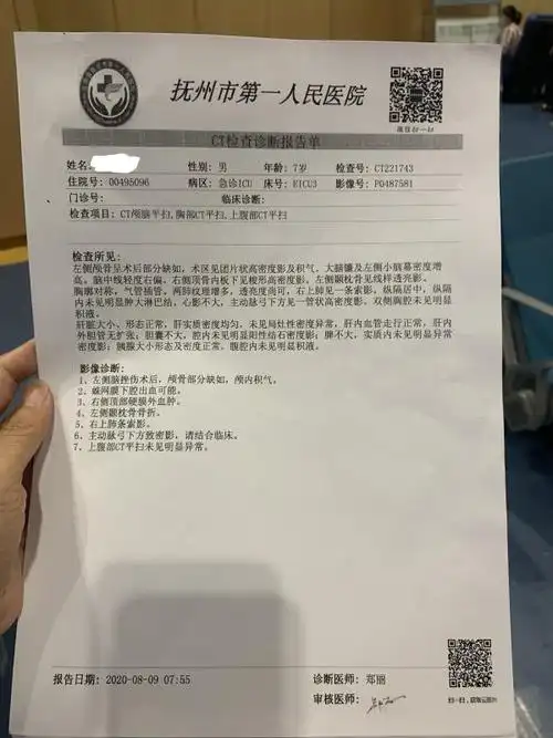 抚州市第一人民医院出具的ct诊断报告.