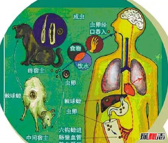 胸部寄生虫是什么怎么辨别皮肤有寄生虫严重会危及生命