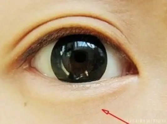 在相学中是主管此人有没有子嗣的面相;鱼尾纹是在人眼角和鬓角之间