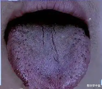 你有淤血吗身体两处变黑了就可能有淤血