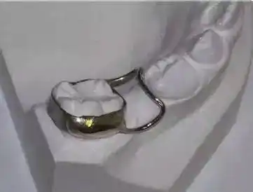 乳恒牙替换时应注意的问题