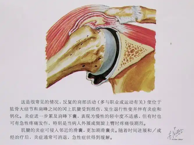 治疗膝关节滑囊炎的药物比较有效