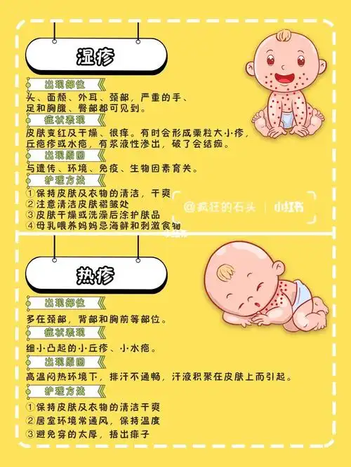 73宝宝湿疹皮肤问题怎么护理