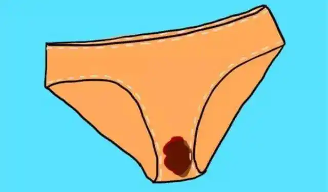 女性发现宫颈必须在非排卵期和非经期出血,如tct和hpv.