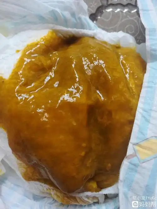 甚至加重腹泻,在此提醒您抗生素不是万能药4宝宝拉稀,就一定是腹泻不