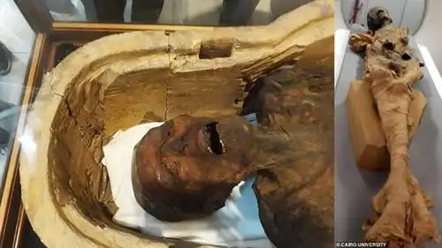 学家1881年在卢克索的德尔埃尔巴哈里皇家陵墓中发现一具女性木乃伊