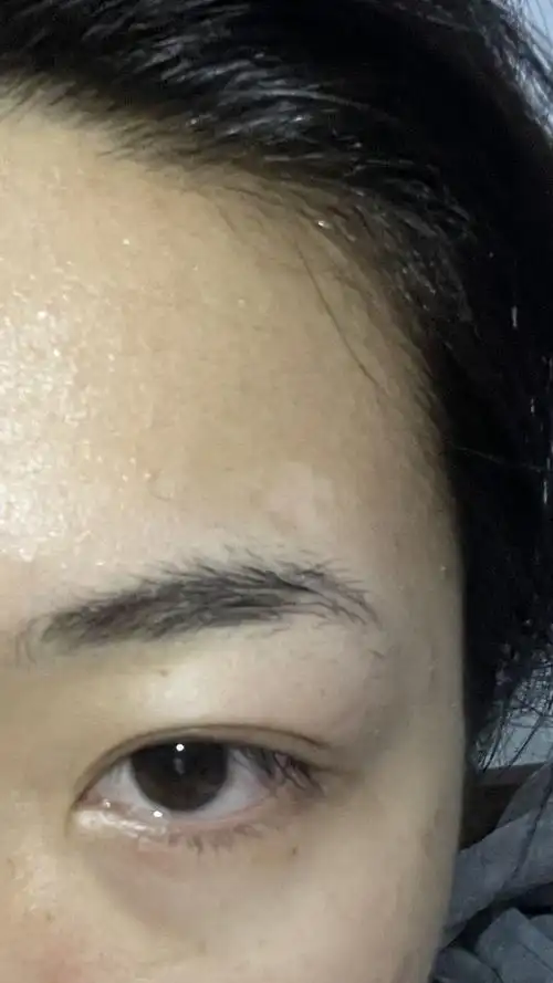 眉毛上面有块白的,从小就有,也没有扩大迹象,身上也没有其他.