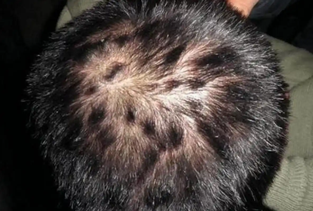 头皮银屑病,这些治疗的坑80%的患者踩过  很多银屑病患者,头皮上都会