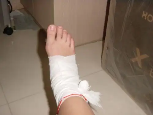 真实腿部受伤图片 (17)_有来医生