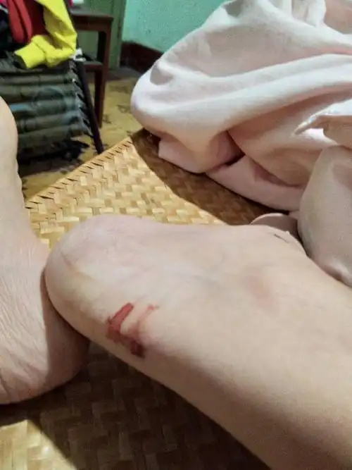 图片上我的脚上的血到底是我自己的血还是别人的血?