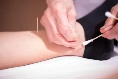 在身体脚踝处找针灸的穴位