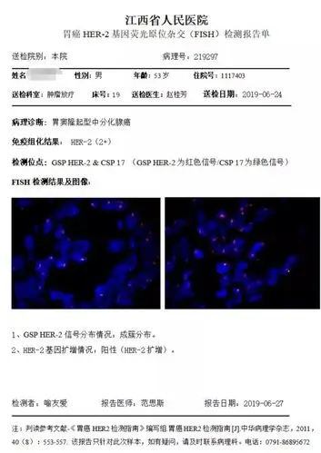 胃癌和乳腺癌fish报告theend