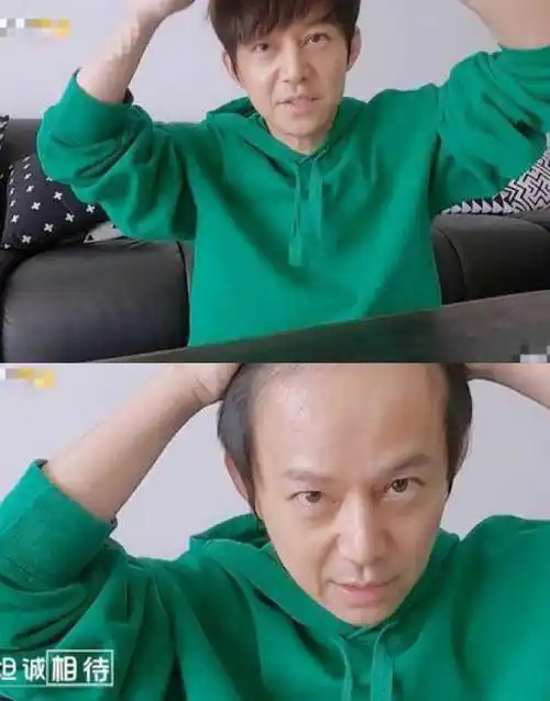 直到看到他自爆的素颜照和掀刘海照才知道,46岁的何炅是真的老了