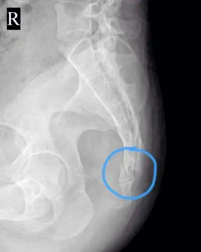 众所周知,人类从猿人进化过来,尾巴也随着退化成尾椎骨.