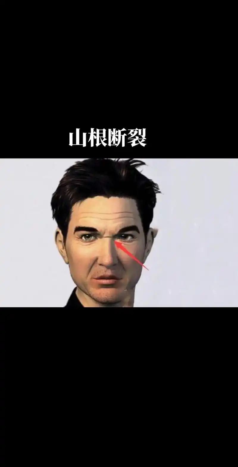 山根断面相的男人如果你老公山根断,尽管鼻子长得好如梁朝伟. - 抖音