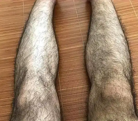 为什么有些男生腿毛浓密有些男生光秃秃涨知识了