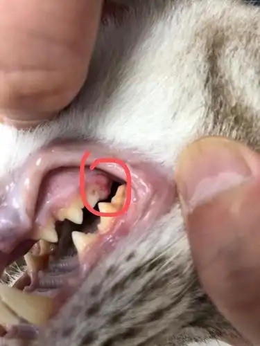 讨论牙龈增生一般怎么治疗一定要去医院切除吗