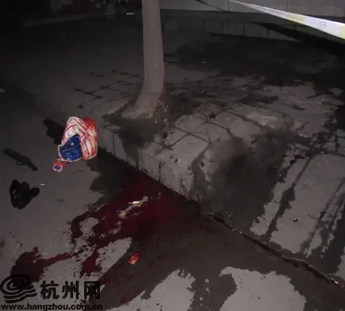 宝马男深夜遭刀砍