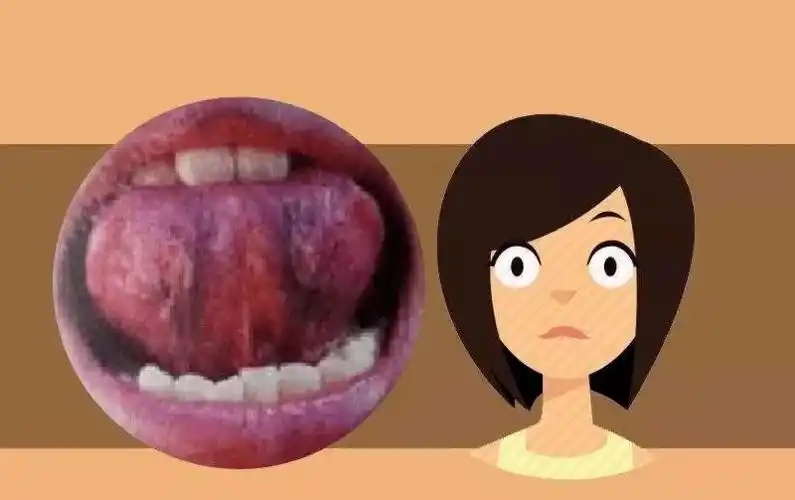 就像刚才提到的"静脉曲张",这是我们能够看得到的,而我们身体内里看不