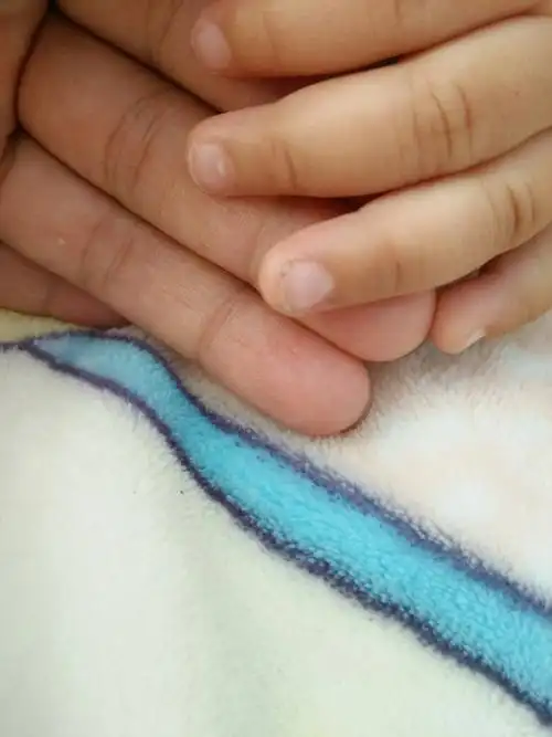 问:11个月宝宝指甲上有白斑是怎么回事?求解