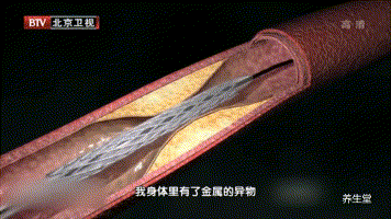 356_200gif 动态图 动图