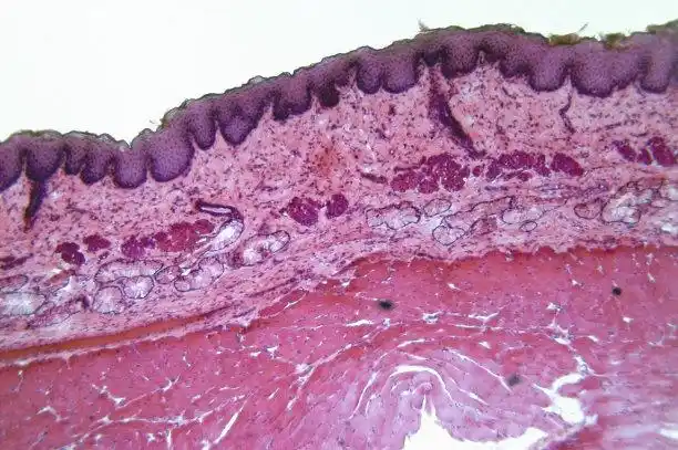 复层鳞状上皮图片