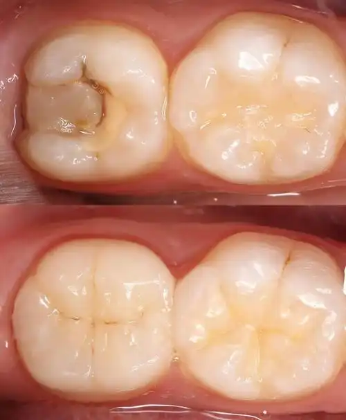 武汉看口腔哪个医院好_儿童口腔护理