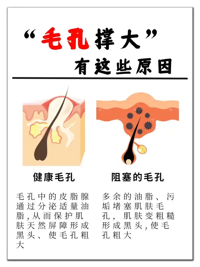 毛孔粗大是大家都有的皮肤 - 抖音